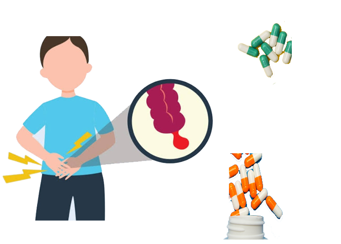 آیا آپاندیسیت در کودکان با آنتی بیوتیک قابل درمان است؟
