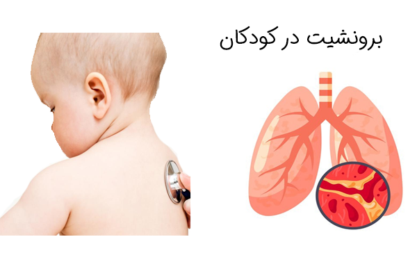 برونشیت در کودکان